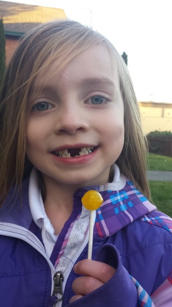 Another Lost Tooth